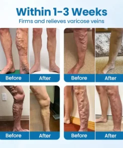 Timilk® VeinGuard Herbal Spray